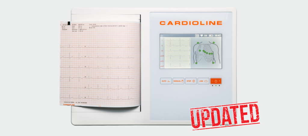 ECG200L UPDATE