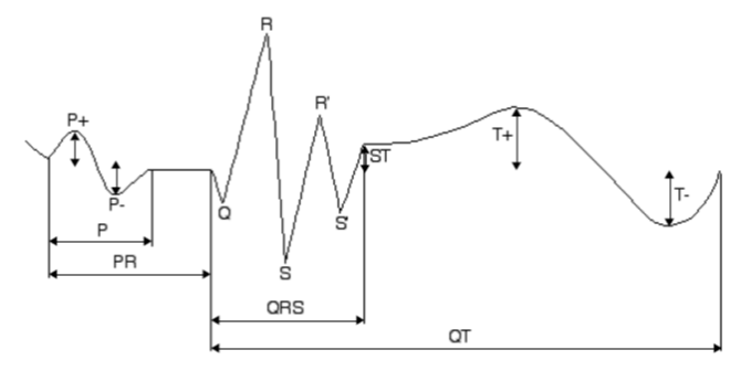 Glasgow EKG Interpreter
